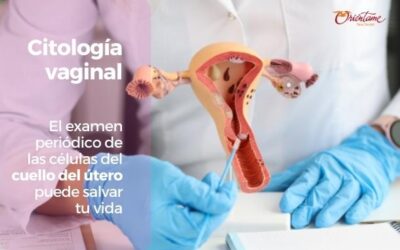 Citología vaginal