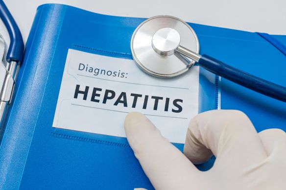 hepatitis C