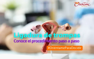 Ligadura de trompas uterinas: conoce el procedimiento paso a paso
